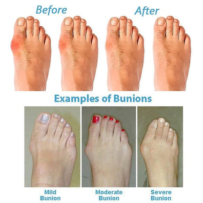 Orthopedic Cushioned Sandals — Anatomic Footbed