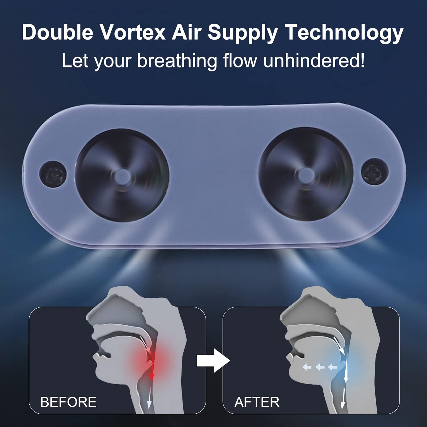 Micro CPAP Anti-Snoring Device for Mild Sleep Apnea